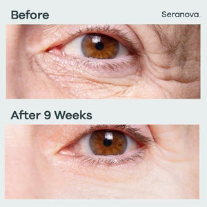 Seranova