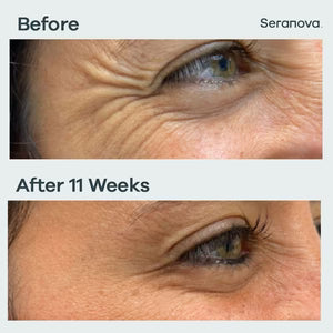 Seranova