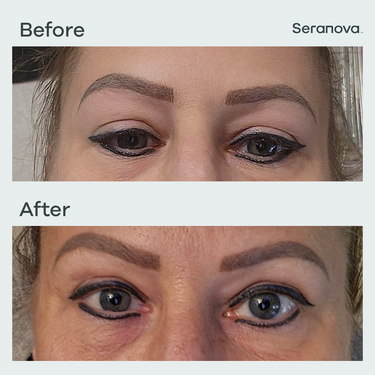 Seranova 