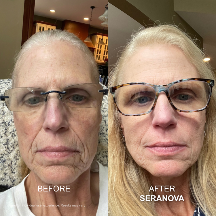 Mouth wrinkles customer transformation