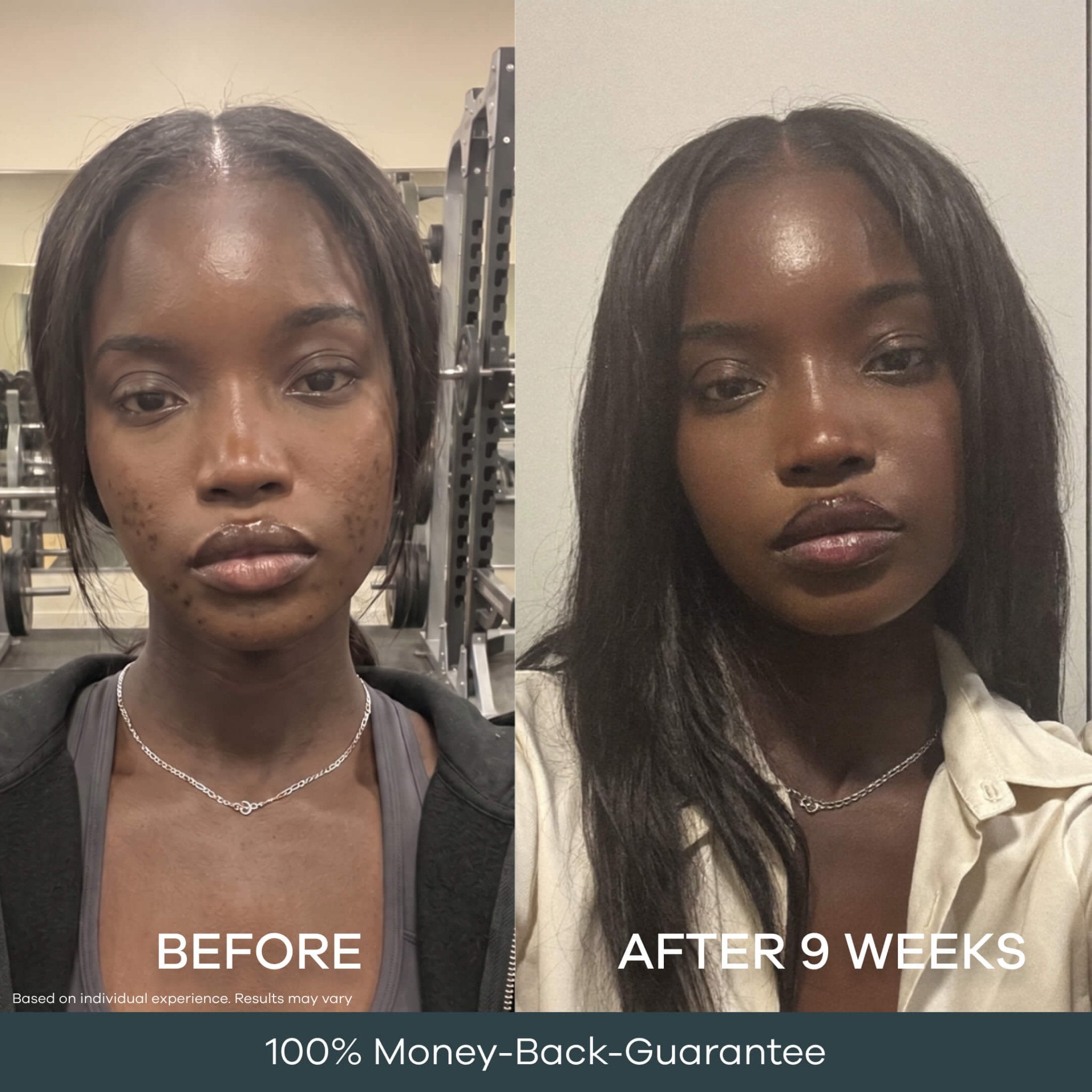 The Micro Infusion Pigmentation System™ - Seranova