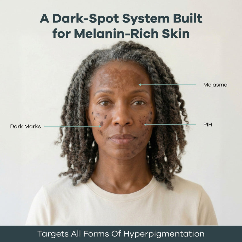 The Micro Infusion Pigmentation System™ - Seranova