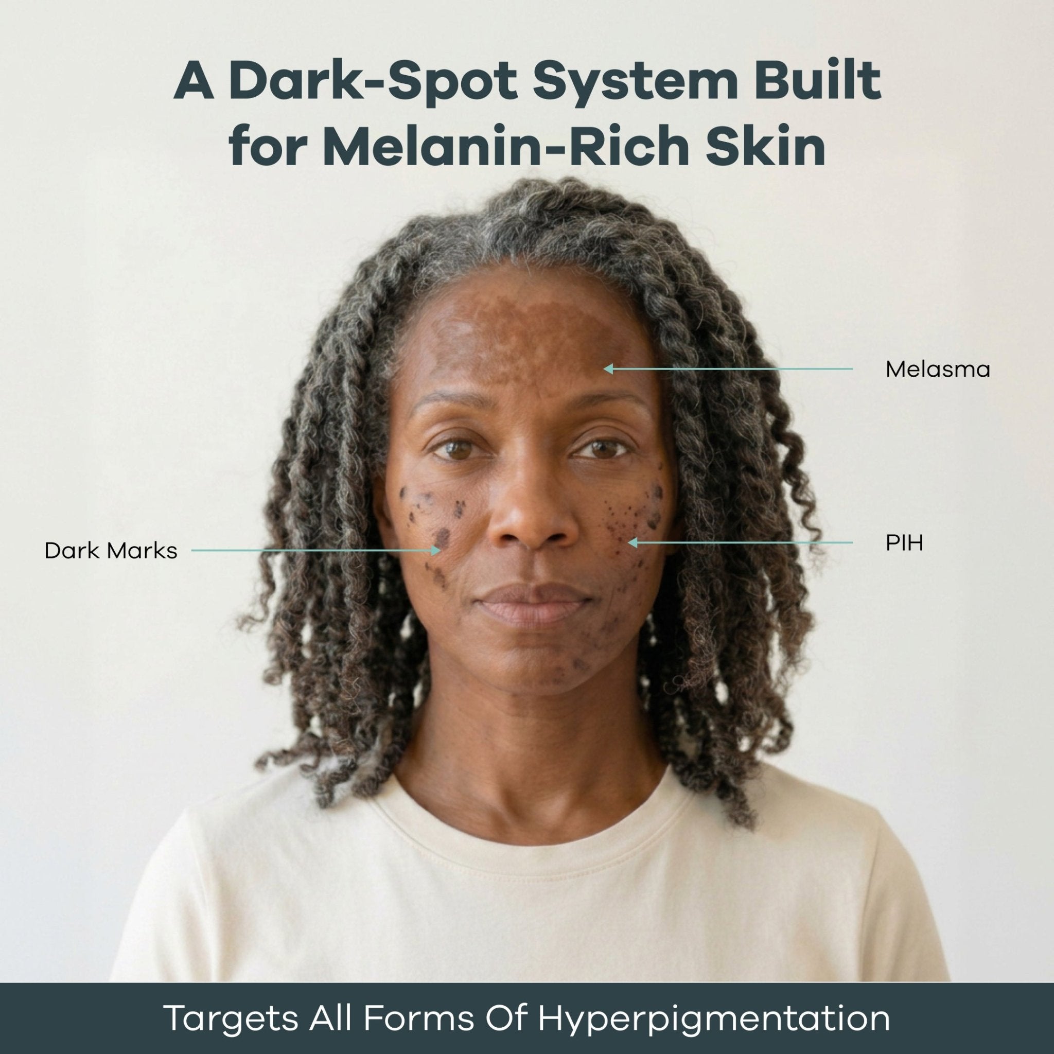 The Micro Infusion Pigmentation System™ - Seranova
