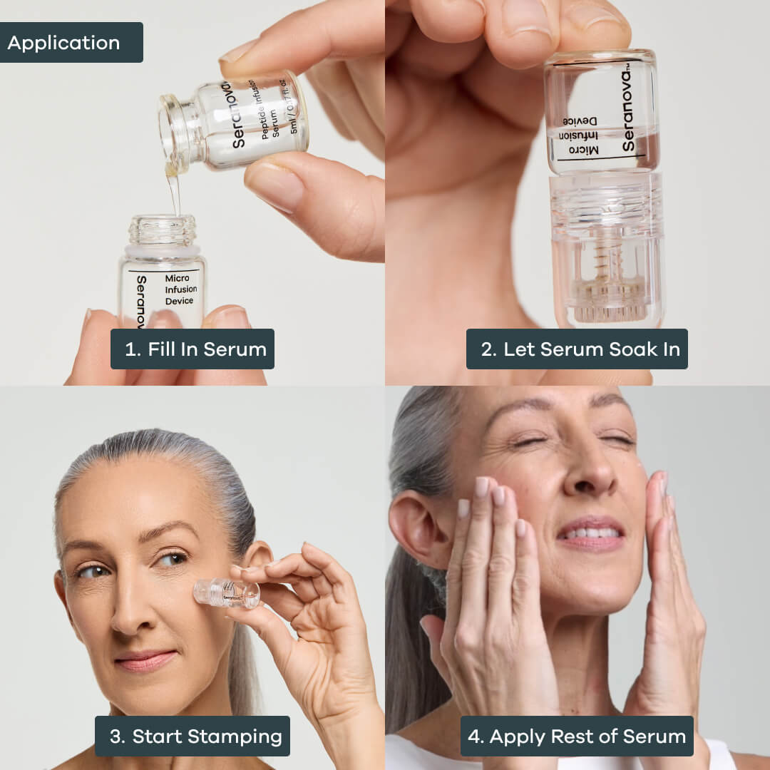 The Micro Infusion System™ - Seranova