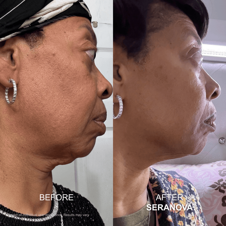 Neck skin customer transformation