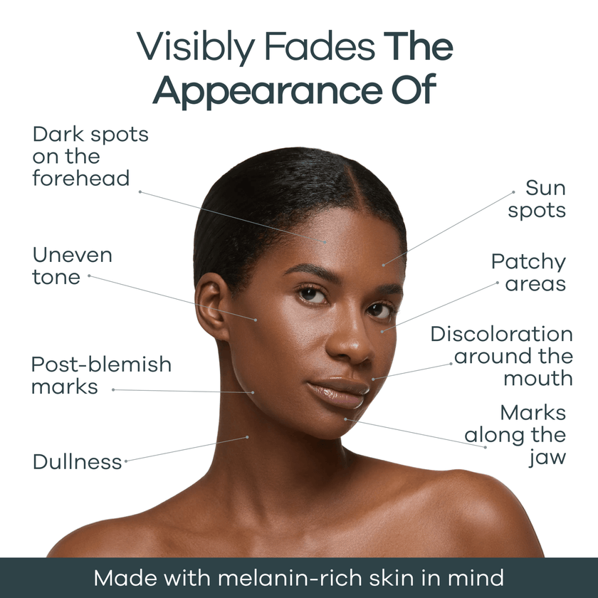 The Micro Infusion System™ Pigmentation For Melanin-Rich Skin - Seranova